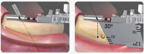 Safe surgery
