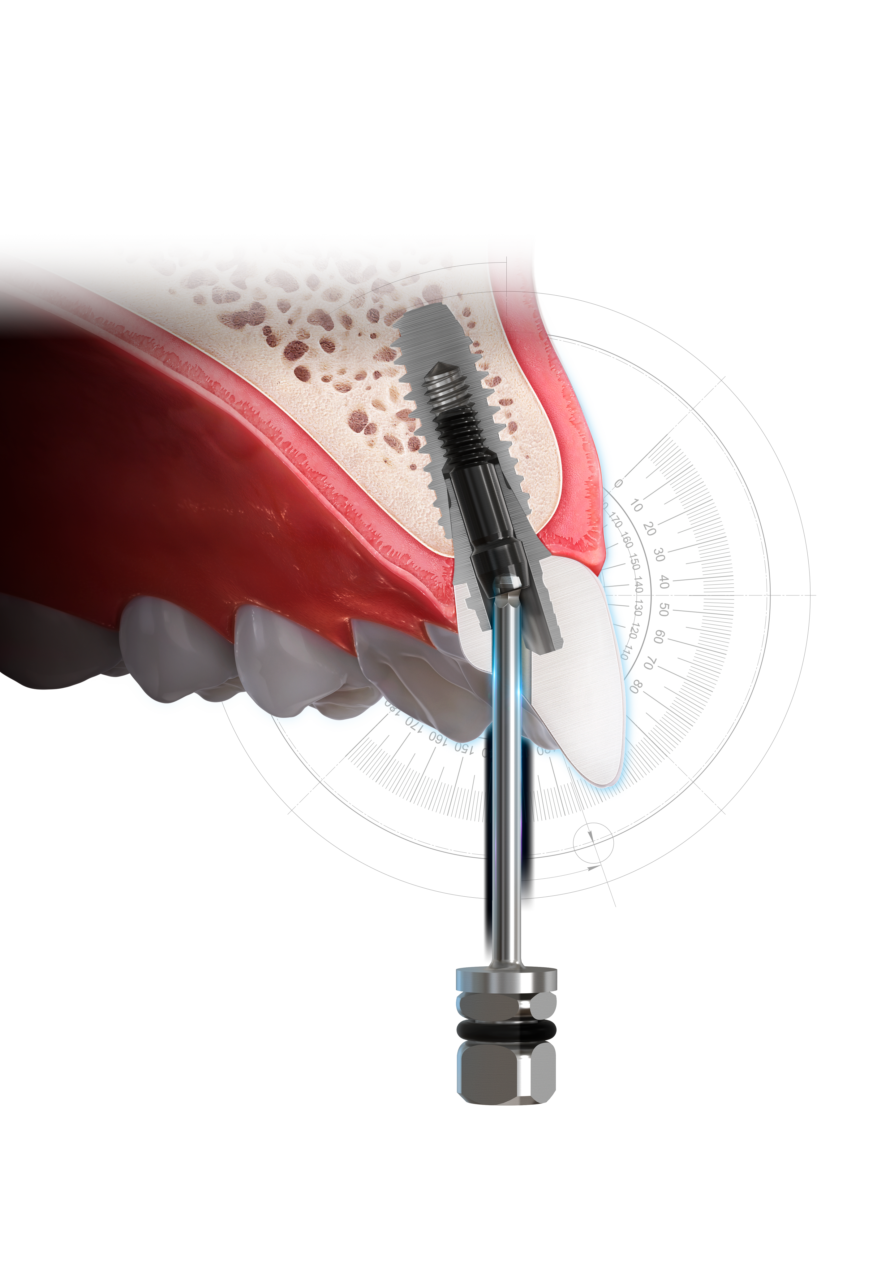 Angle torque driver