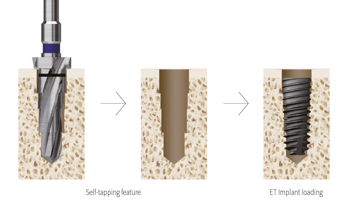 Safe and stable Taper Kit Feature1
